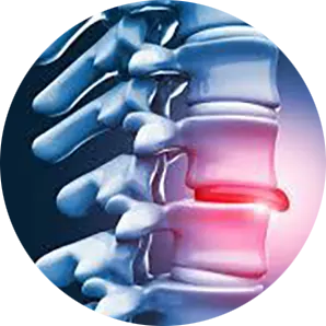 Disc Injury Treatment Near Me in Arlington, TX. Chiropractor for Disc Injury Relief.